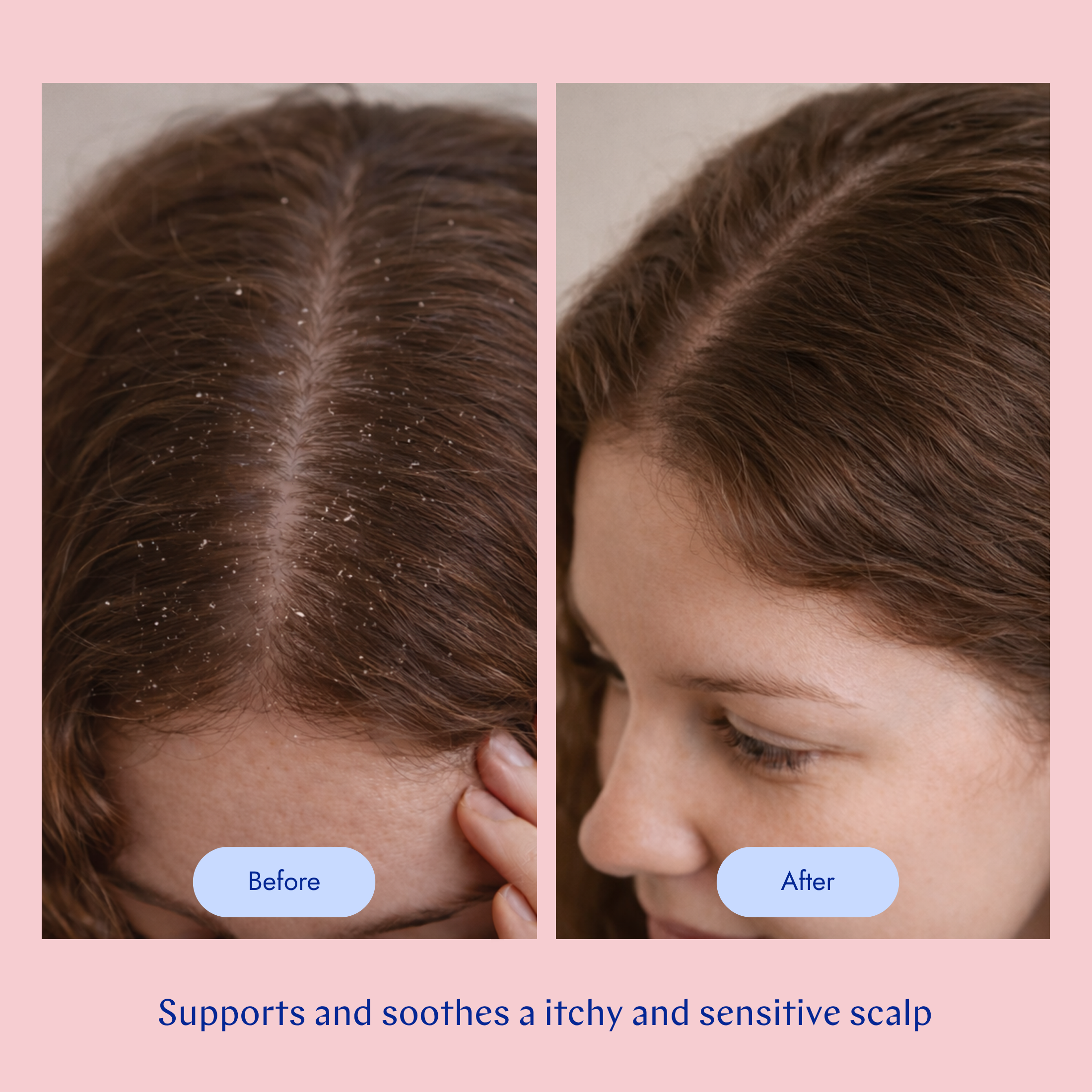 Sensitive Conditioner